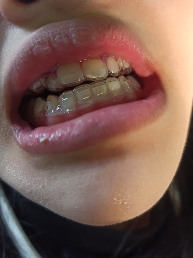 Af1qippevxyk9iy Ddy7mm7rwvzmkkiijxtjgffoqln7