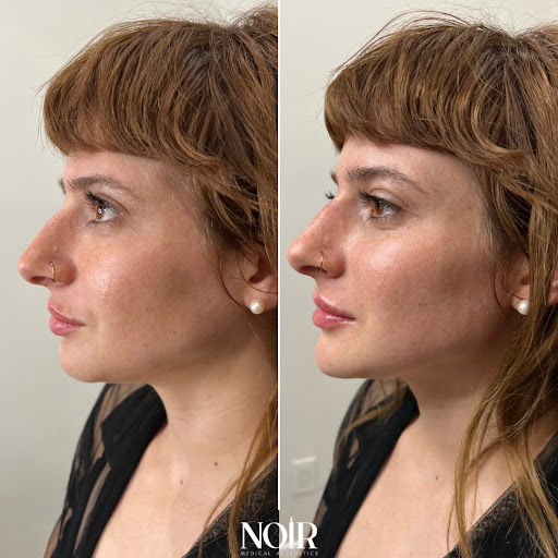 Noir Medical Aesthetics image