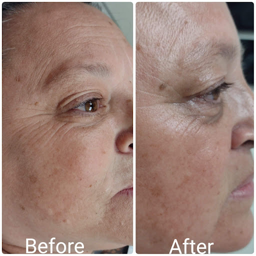 Explore tree tattoo ideas, creative tattoo ideas in Brighton, available at Tip of the Spear Laser Esthetics