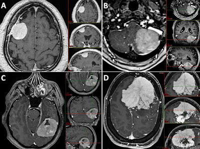 Dr Charles CHAMPEAUX DEPOND - Neurochirurgien à Marignane