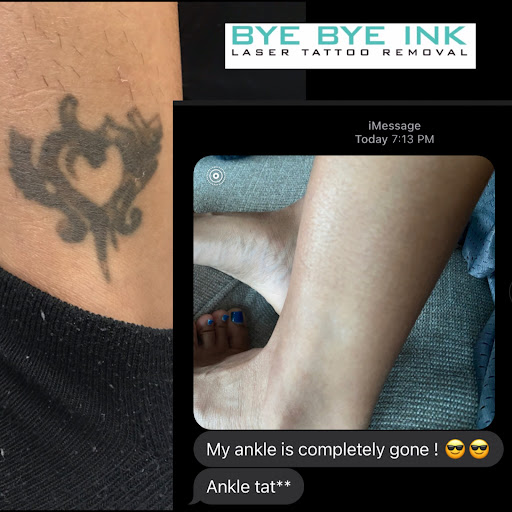 Explore karma tattoo ideas, creative tattoo ideas in Middle Village, available at Bye Bye Ink Laser Tattoo Removal