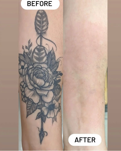 Explore hammer tattoo ideas, creative tattoo ideas in Rowlett, available at Bonsai Laser Tattoo Removal