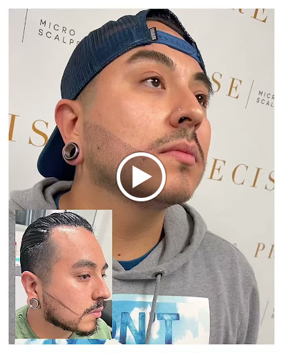 Precise Scalp Micro - Scalp Micropigmentation Service and Training image