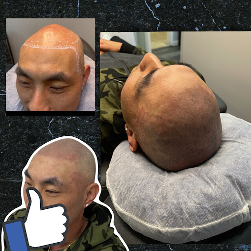 Explore zero tattoo ideas, creative tattoo ideas in Roseville, available at NuHair Ink. Scalp MicroPigmentation & Aesthetic Clinic of Sacramento