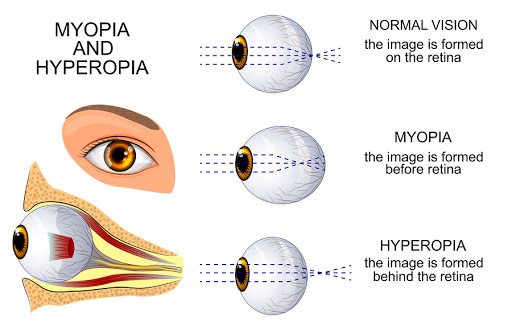 Optometrist «Advanced Eyecare Consultants», reviews and photos, 48 S Old Rand Rd Suite 104, Lake Zurich, IL 60047, USA