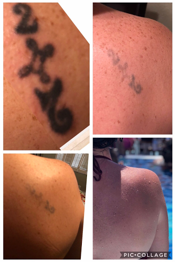 Explore 1996 tattoo ideas, creative tattoo ideas in Pinellas Park, available at St Pete Tattoo Removal