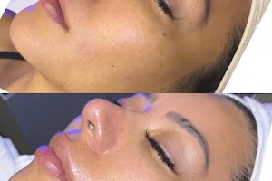 Best Brow Spa and Laser - HydraFacial MD |Morpheus 8 image