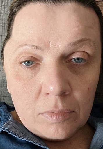 Explore stupid tattoo ideas, creative tattoo ideas in Fenton, available at Skin & Vein Center