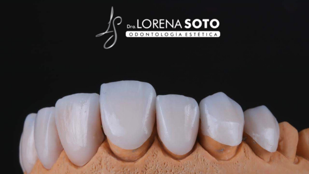 Dra. Lorena Soto Odontología Estética