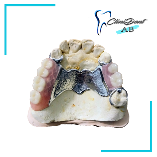 Clinident AB