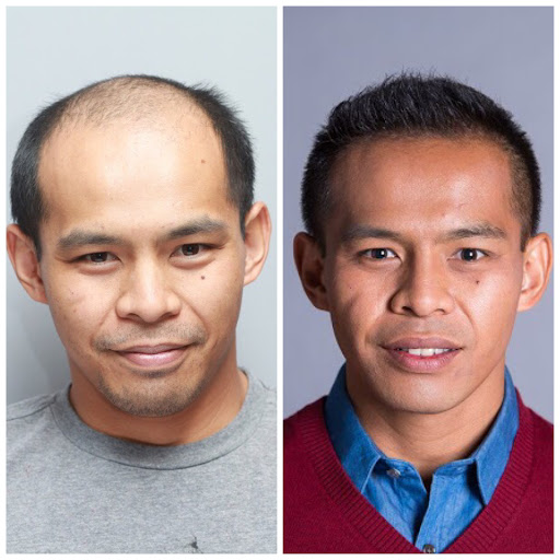 Hair Transplantation Clinic «Bosley Medical - Dallas», reviews and photos, 5949 Sherry Ln #1150, Dallas, TX 75225, USA