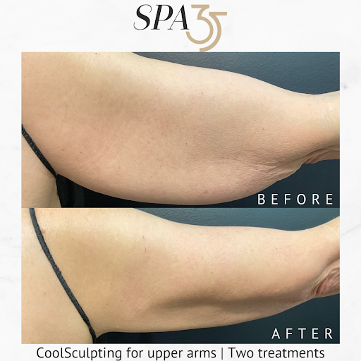 Explore badass tattoo ideas for women, creative tattoo ideas in Boise, available at Spa 35 Med Spa