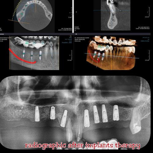 Cabinet Stomatologie Implantologie MADIDENT CLINIC Abrud - <nil>