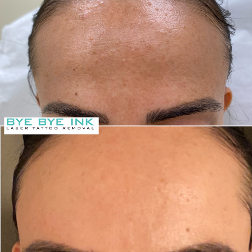 Explore japanese tattoo ideas with meaning, creative tattoo ideas in Middle Village, available at Bye Bye Ink Laser Tattoo Removal