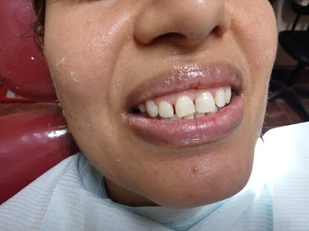Panama Dental Lab - Panama Dental Lab