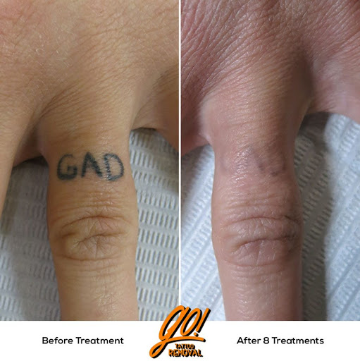 Explore gator tattoo ideas, creative tattoo ideas in Allentown, available at Removery Tattoo Removal & Fading