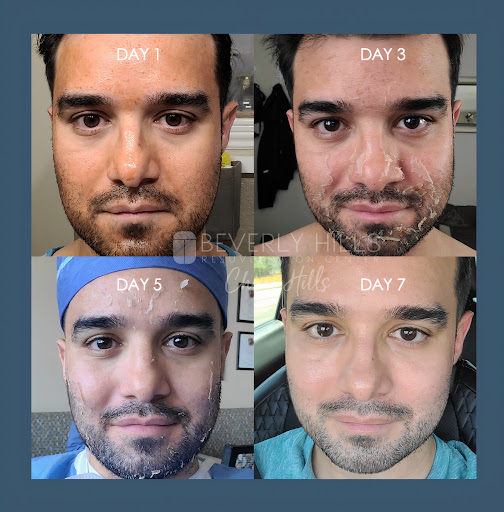 Beverly Hills Rejuvenation Center image
