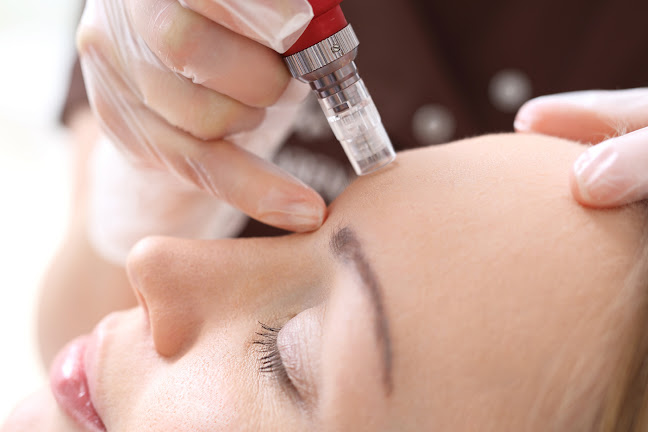 ️⭐️ Madame Beauty Institut (Kosmetik / Laser Haarentfernung / Tattooentfernung / Faltenunterspritzung / Lippen aufspritzen - Locarno