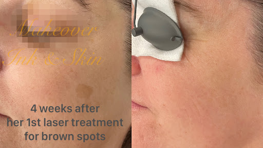 Explore scar tattoo ideas, creative tattoo ideas in Hillsboro, available at Makeover Ink & Skin