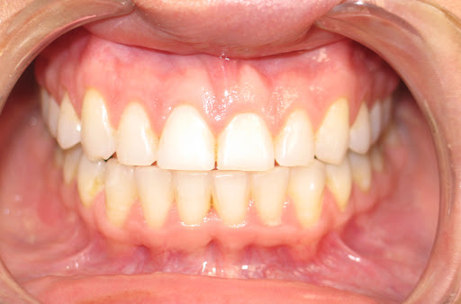 Smile Shapers Dental: Dr. Eva M. Goriee
