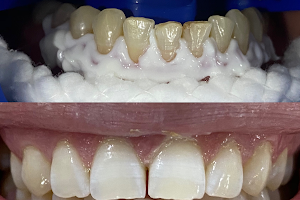 İlker Cemal Kavasoğlu Diş Kliniği / Dental İN Ağız Ve Diş Sağlığı Polikliniği / Dentalin image
