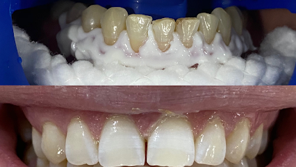 İlker Cemal Kavasoğlu Diş Kliniği / Dental İN Ağız Ve Diş Sağlığı Polikliniği / Dentalin