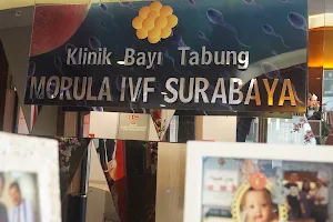 Morula IVF Surabaya image