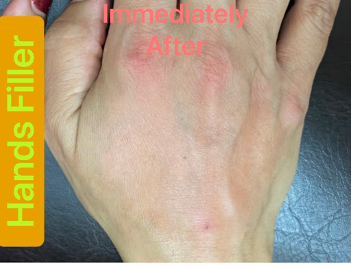 Explore 1/2 sleeve tattoo ideas, creative tattoo ideas in Lake Oswego, available at Lake Oswego Vein and Aesthetic LOVA