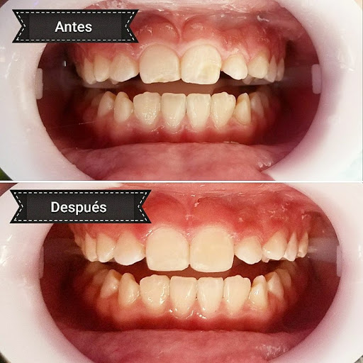 Consultorio Dental White Smile