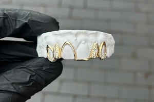 Ouro Gold Teeth Birmingham image