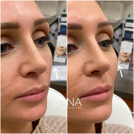 Skin Care Clinic «ZONA MED SPA», reviews and photos, 9767 N 91st St #102, Scottsdale, AZ 85258, USA