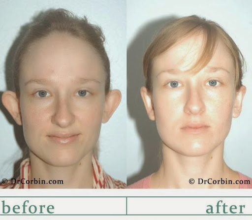 Dr. Corbin Plastic Surgery image