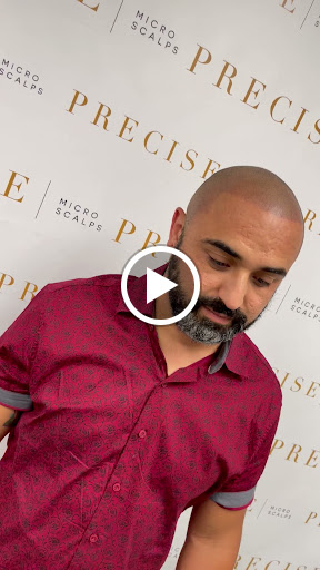 Precise Scalp Micro - Scalp Micropigmentation Service and Training image