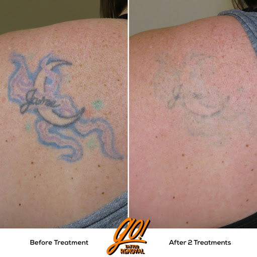 Explore venom tattoo ideas, creative tattoo ideas in Allentown, available at Removery Tattoo Removal & Fading