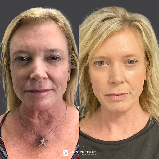 Explore tattoo ideas inner arm, creative tattoo ideas in Whittier, available at Skin Perfect Medical Aesthetics