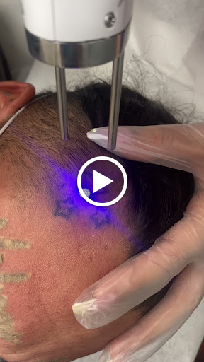 Explore griffin tattoo ideas, creative tattoo ideas in Tucson, available at Allure Medical