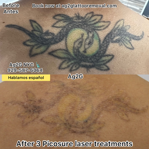 Explore compass rose tattoo ideas, creative tattoo ideas in New York, available at Ag2g Laser Tattoo Removal & MedSpa