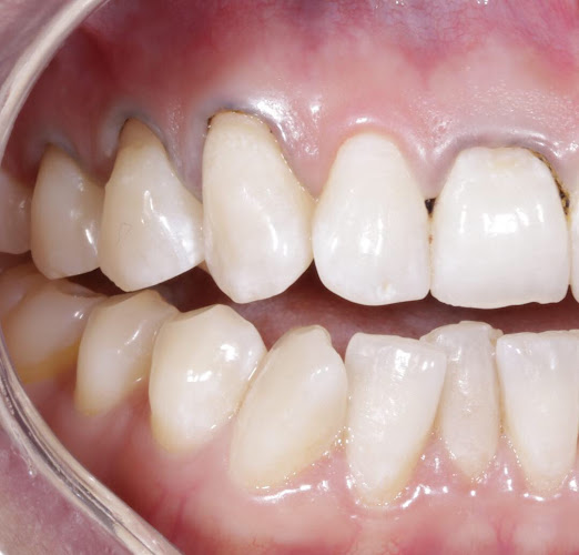 Opiniones de Gm dental en Cuenca - Dentista