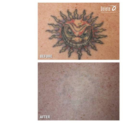 Explore inner bicep tattoo ideas for guys, creative tattoo ideas in Phoenix, available at Removery Tattoo Removal & Fading