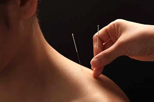 Acupuncture Isabelle Dufresne - Sherbrooke image