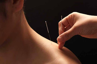 Acupuncture Isabelle Dufresne - Sherbrooke