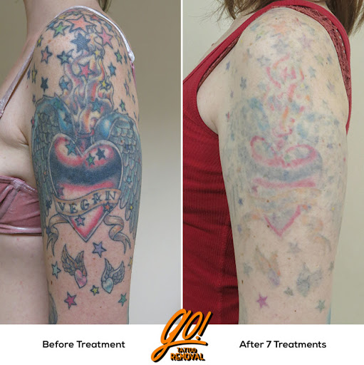 Explore tattoo ideas for men wolf, creative tattoo ideas in Allentown, available at Removery Tattoo Removal & Fading