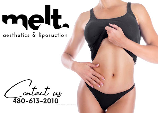 Melt Aesthetics and Liposuction Arizona modern liposuction