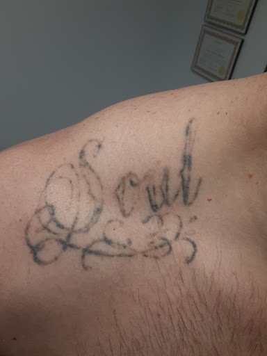 Explore cystic fibrosis tattoos idea, creative tattoo ideas in Saint Paul, available at Fearless Tattoo Removal