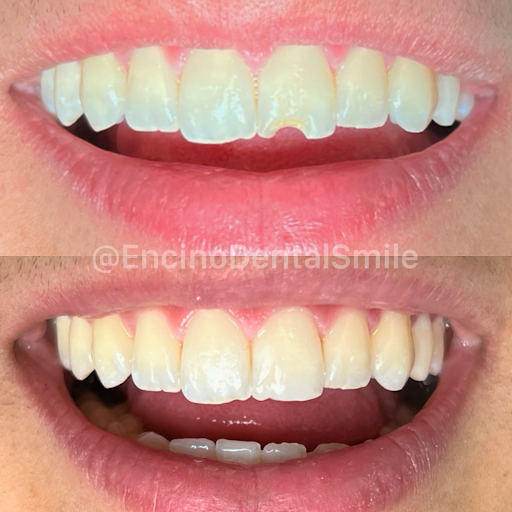 Encino Dental Smile image