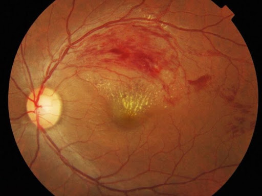 Abraham Eye Center image