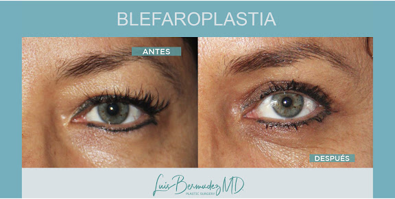 Ciruestetic Dr. Luis Bermudez M.D. - Ciruestetic Dr. Luis Bermudez M.D.