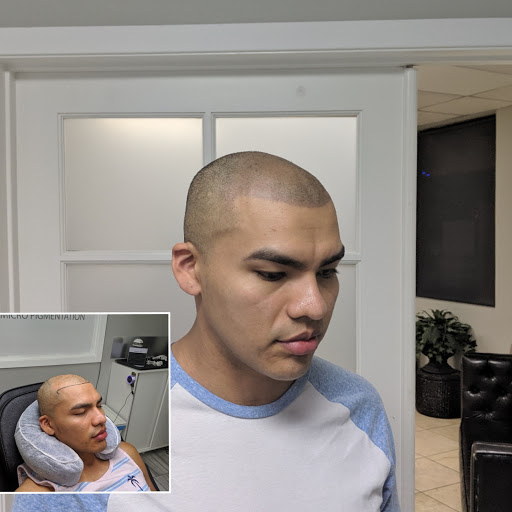 Explore finger tattoo cover up ideas, creative tattoo ideas in Roseville, available at NuHair Ink. Scalp MicroPigmentation & Aesthetic Clinic of Sacramento