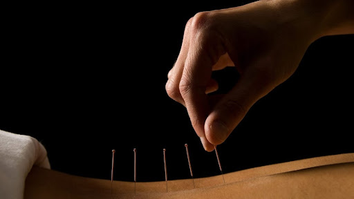 Kinetoterapie, fizioterapie, acupunctura neuro-musculara dry needling, masaj byTerapeut Cristian Spînu