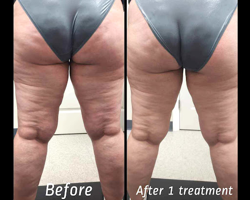 Explore good tattoo ideas with meaning, creative tattoo ideas in Brighton, available at Tip of the Spear Laser Esthetics